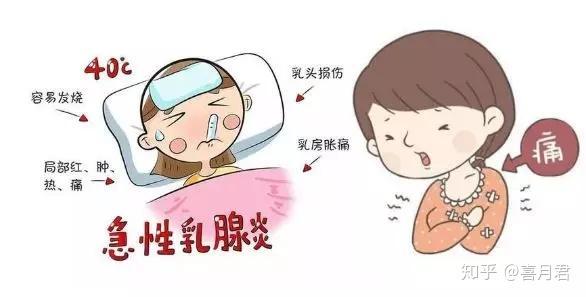 乳腺炎反復(fù)發(fā)作？這6個方法很管用