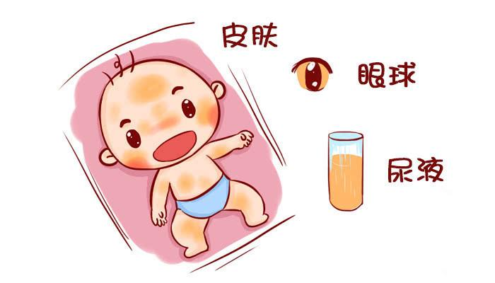 新生兒出生沒(méi)黃疸，大多是孕媽在孕期做了3件事