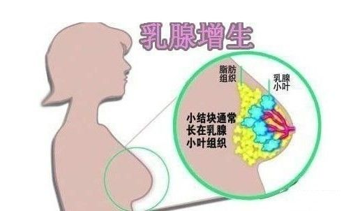 乳房出現(xiàn)“青筋”是什么原因呢？