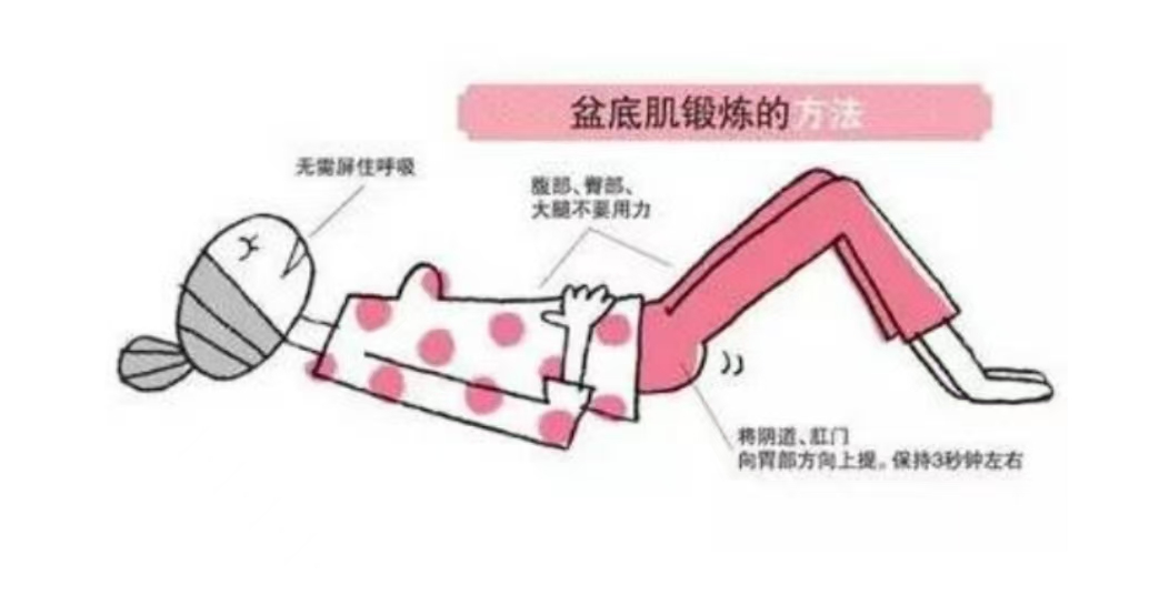 產后如何自己進行盆底肌訓練