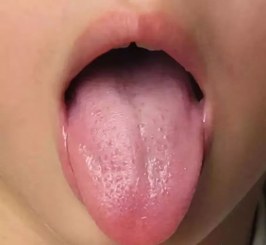 過度喂養(yǎng)危害大，寶寶發(fā)出的積食信號你能看懂多少？