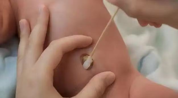 肚臍眼里的污垢，到底能不能摳？ 