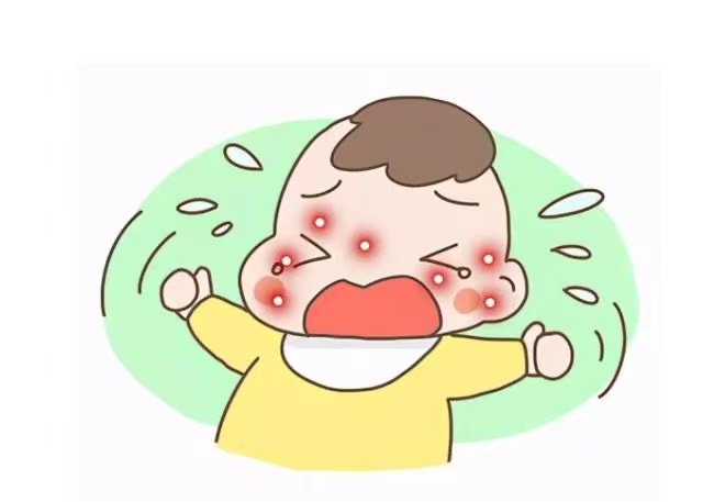 孩子濕疹反復(fù)發(fā)作怎么辦？這些防治方法請(qǐng)收好！